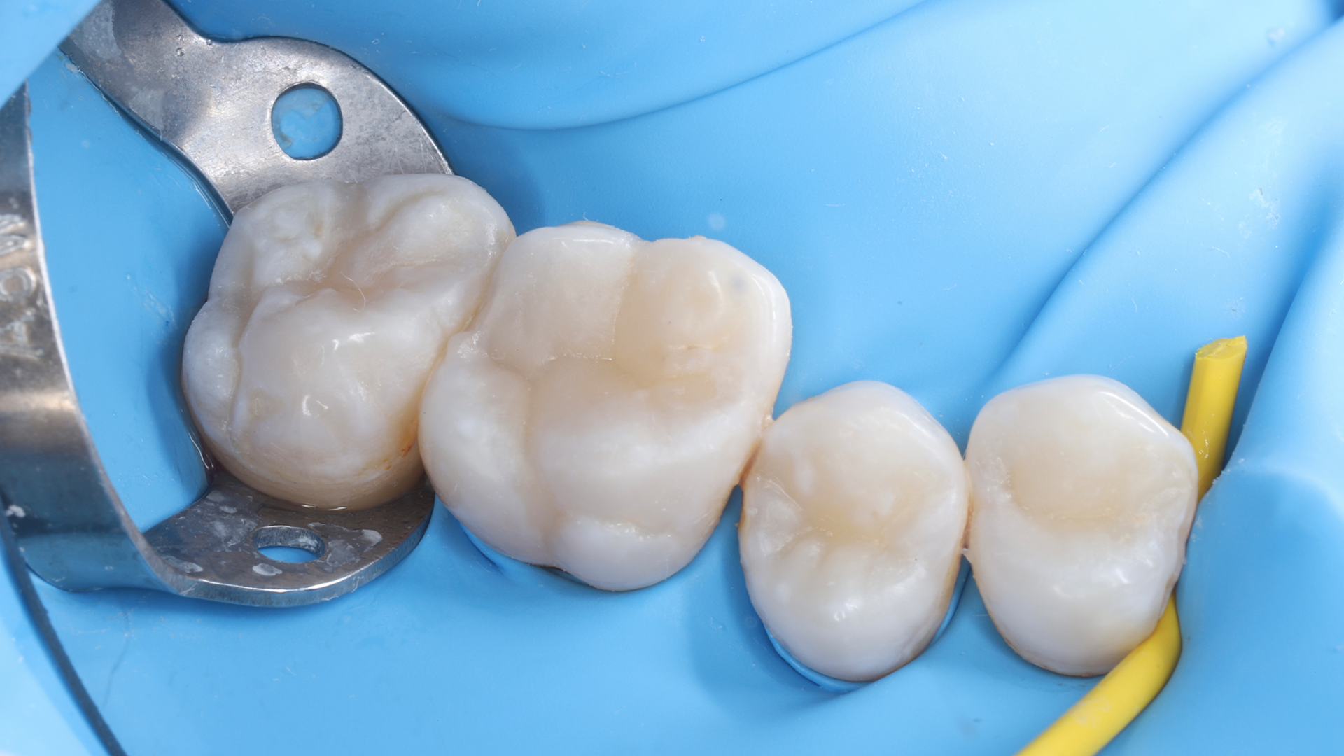 Отбеливание